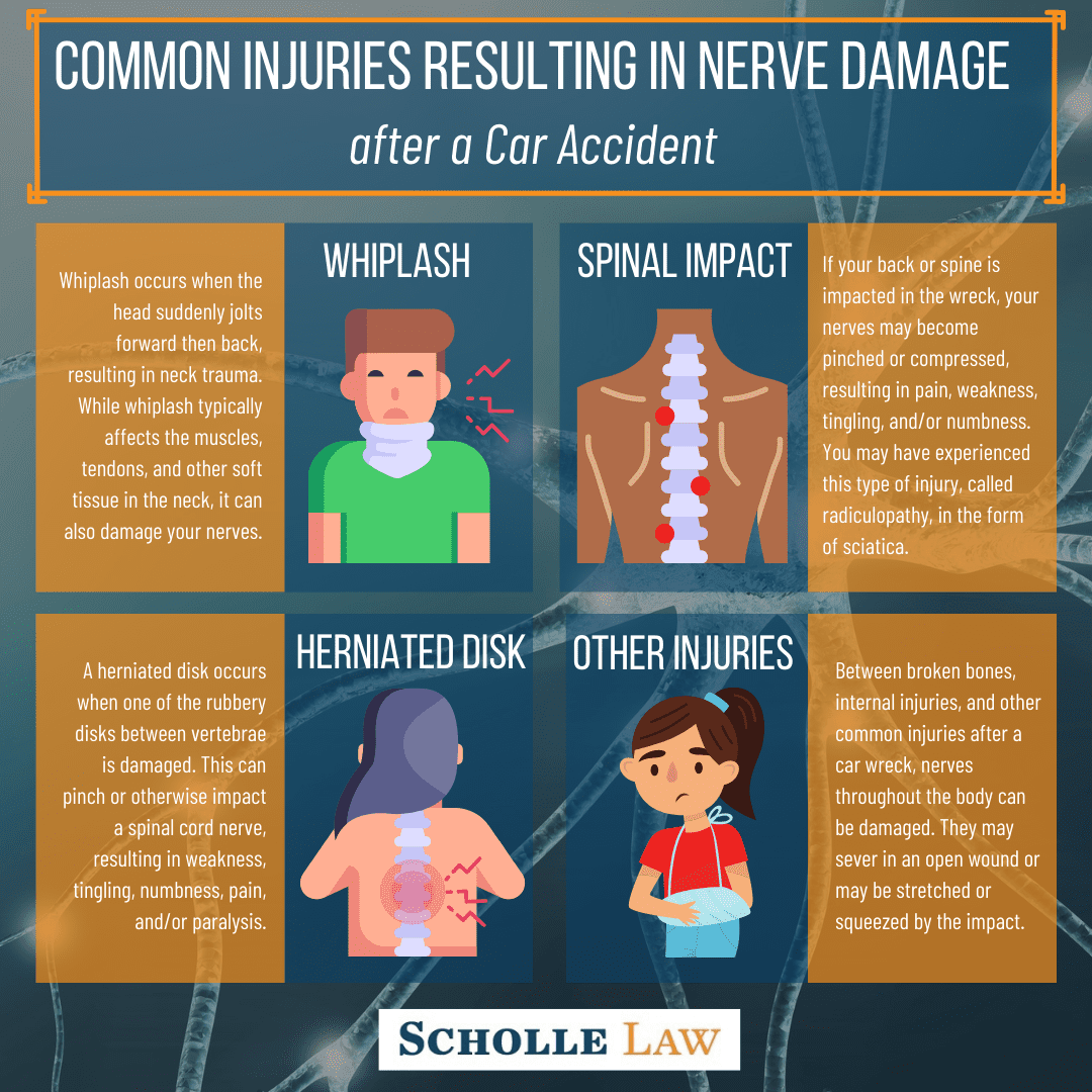 Can a Car Accident Cause a Pinched Nerve?