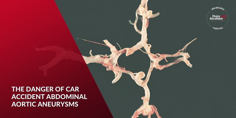 Can a Car Accident Cause an Aneurysm?