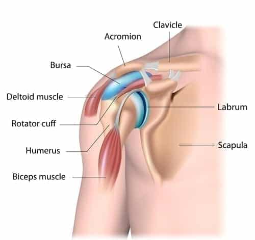 Can a Car Accident Cause Bursitis?