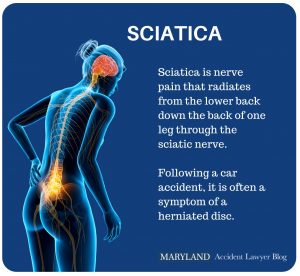 Can a Car Accident Cause Sciatica Nerve Pain?