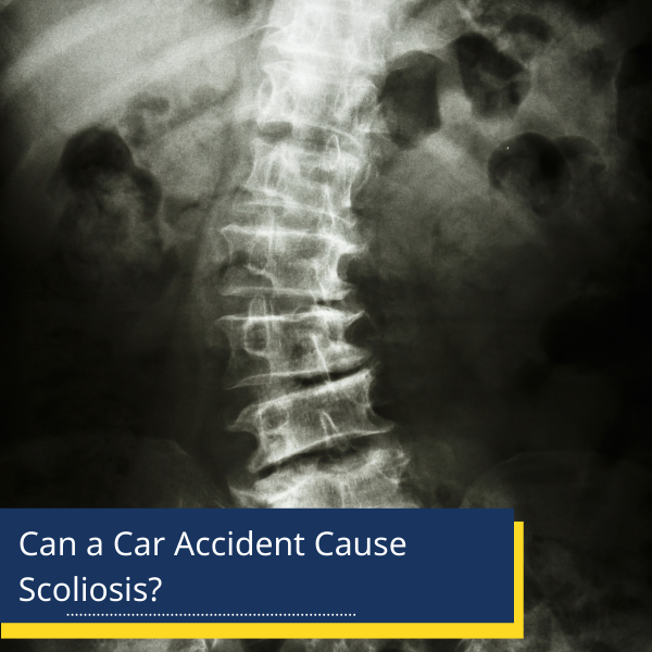 Can a Car Accident Cause Scoliosis?