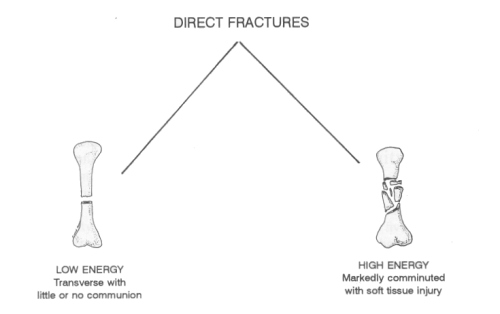 Directly Vs Indirectly Personal Injury