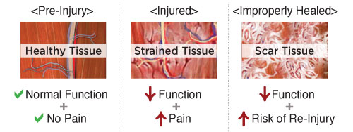 How to Treat Muscle Pain After a Car Accident?